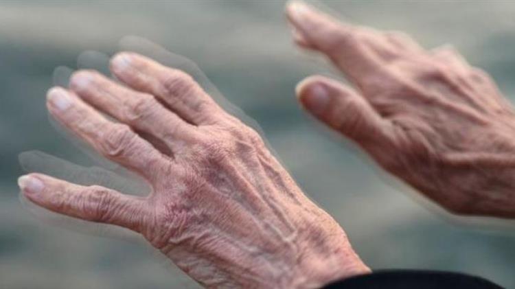 Πάρκινσον: Οι δίαιτες που επιβραδύνουν την εκδήλωση της νόσου