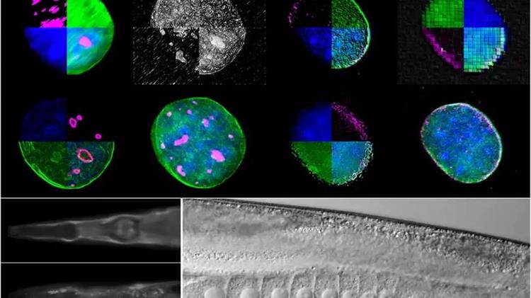 Νέο μοριακό μηχανισμό που ρυθμίζει τη γήρανση και την αναπαραγωγή αποκάλυψαν ερευνητές του ΙΤΕ