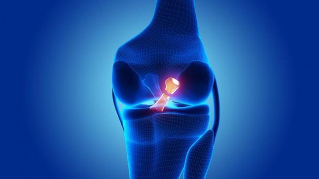 Ρήξη Πρόσθιου Χιαστού Συνδέσμου